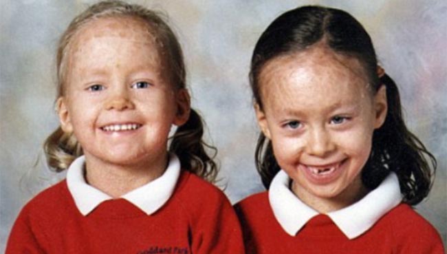 Emma (left) and Stacey Picken younger