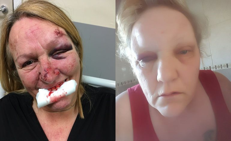 Aycliffe women appeal after brutal Silverdale Place attack